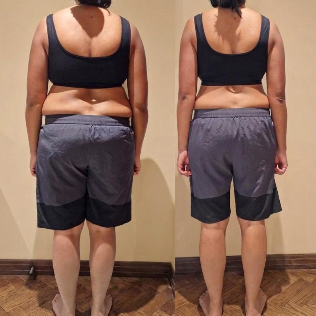 Client transformation image back view