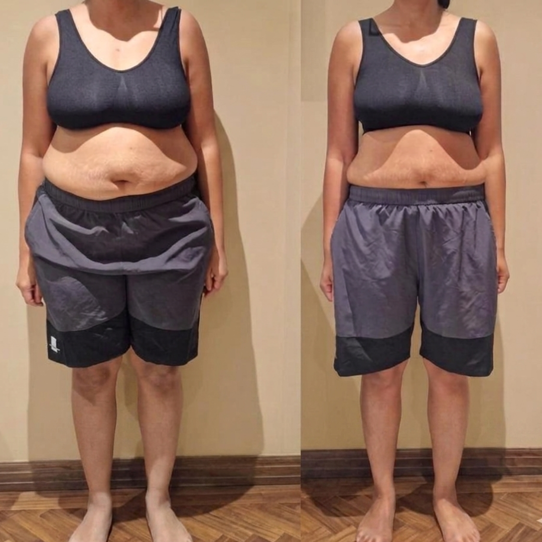 Client transformation image front view