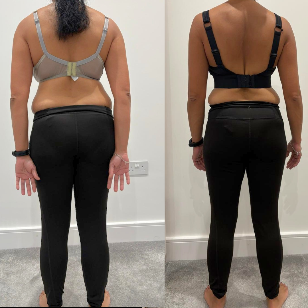 Client transformation image back view