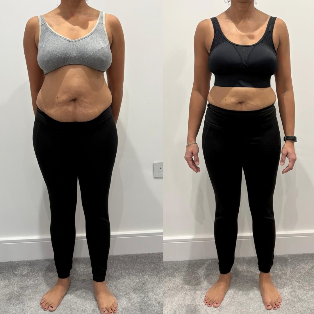 Client transformation image front view
